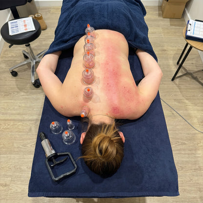 Dry Cupping Therapy